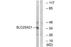 Western blot analysis of extracts from HepG2 cells, using SLC25A21 Antibody. (SLC25A21 anticorps  (AA 134-183))