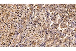 Detection of TBG in Porcine Adrenal gland Tissue using Polyclonal Antibody to Thyroxine Binding Globulin (TBG) (SERPINA7 anticorps  (AA 128-415))