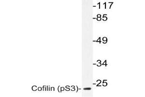 Western blot (WB) analyzes of p-Cofilin antbody in extracts from 3T3 paclitaxel cells. (Cofilin anticorps  (pSer3))