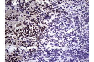 Image no. 6 for anti-Nibrin (NBN) (AA 183-460) antibody (ABIN1491066)