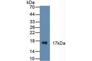 Figure. (CST6 anticorps  (AA 29-149))