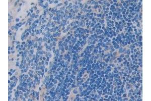 Detection of SIGIRR in Rat Spleen Tissue using Polyclonal Antibody to Single Ig IL1 Related Receptor (SIGIRR)