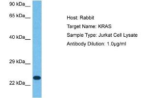 Host: Rabbit Target Name: KRAS Sample Tissue: Human Jurkat Whole Cell Antibody Dilution: 1ug/ml