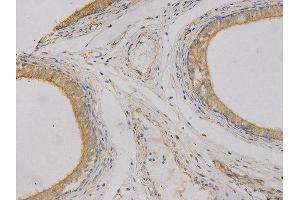 Immunohistochemistry (IHC) image for anti-Carcinoembryonic Antigen-Related Cell Adhesion Molecule 3 (CEACAM3) antibody (ABIN1871781) (CEACAM3 anticorps)