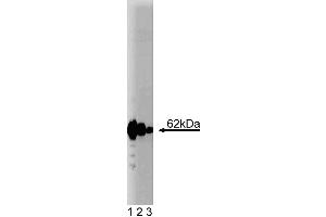 Western blot analysis of p62 Ick ligand on a HCT-8 (human colorectal adenocarcinoma, ATCC CCL-244) cell lysate.