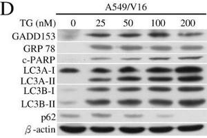Analyses of GMI, TG and TM regulated ER stress, apoptosis and autophagy by Western blotting.