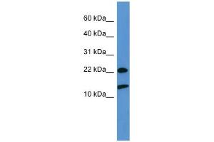 WB Suggested Anti-RPS27A  Antibody Titration: 0. (RPS27A anticorps  (Middle Region))