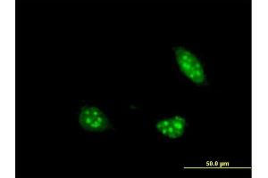 Immunofluorescence of monoclonal antibody to PIM1 on HeLa cell. (PIM1 anticorps  (AA 1-100))