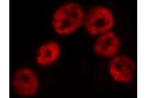 ABIN6275312 staining Hela by IF/ICC. (SP100 anticorps  (Internal Region))