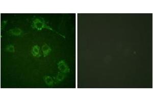 Immunofluorescence analysis of HuvEc cells, using COT (Ab-290) Antibody.