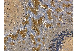MLC1 Antibody at 1/100 staining mouse brain tissue by IHC-P. (MLC1 anticorps)