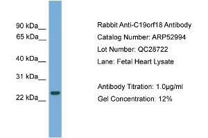 WB Suggested Anti-C19orf18  Antibody Titration: 0.