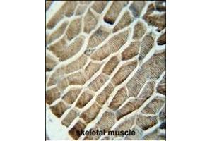 GA1 antibody (N-term) (ABIN654679 and ABIN2844373) immunohistochemistry analysis in formalin fixed and raffin embedded human skeletal muscle followed by peroxidase conjugation of the secondary antibody and DAB staining.