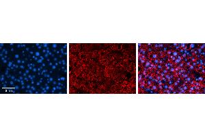 Rabbit Anti-ZNF259 Antibody   Formalin Fixed Paraffin Embedded Tissue: Human Liver Tissue Observed Staining: Nucleus and cytoplasm in hepatocytes Primary Antibody Concentration: N/A Other Working Concentrations: 1:600 Secondary Antibody: Donkey anti-Rabbit-Cy3 Secondary Antibody Concentration: 1:200 Magnification: 20X Exposure Time: 0. (ZNF259 anticorps  (C-Term))