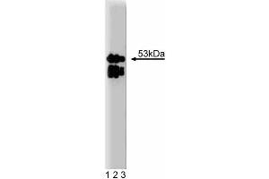 Western blot analysis of LAP2 on a RSV-3T3 cell lysate. (Thymopoietin anticorps  (AA 34-156))