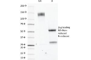 SDS-PAGE Analysis Purified Estrogen Receptor beta1 Mouse Monoclonal Antibody (ERb455). (ESR2 anticorps  (C-Term))
