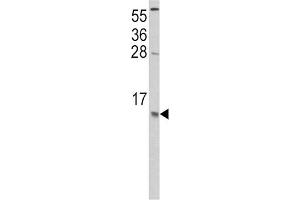 Western Blotting (WB) image for anti-Chemokine (C-C Motif) Ligand 2 (CCL2) antibody (ABIN3002757) (CCL2 anticorps)