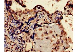 Immunohistochemistry of paraffin-embedded human placenta tissue using ABIN7151618 at dilution of 1:100 (ERVK-6 anticorps  (AA 90-632))
