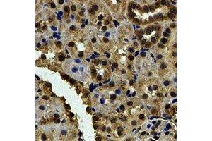 Immunohistochemical analysis of Karyopherin alpha-6 staining in human kidney formalin fixed paraffin embedded tissue section. (KPNA6 anticorps)