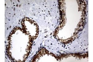 Image no. 2 for anti-Nibrin (NBN) (AA 461-754) antibody (ABIN1491539)