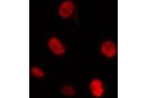 anti-CDC28 Protein Kinase Regulatory Subunit 1B (CKS1B) (N-Term) antibody
