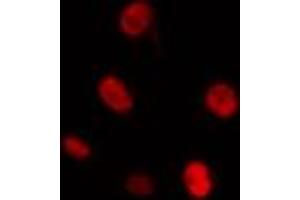 ABIN6274298 staining Hela cells by IF/ICC. (CKS1 anticorps  (N-Term))