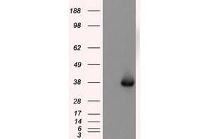 Image no. 2 for anti-Nitrilase Family, Member 2 (NIT2) antibody (ABIN1499737) (NIT2 anticorps)