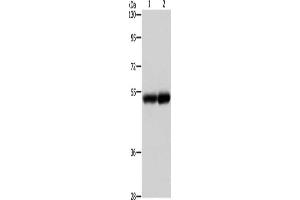 Gel: 8 % SDS-PAGE, Lysate: 40 μg, Lane 1-2: Human liver cancer tissue, Human kidney tissue, Primary antibody: ABIN7191676(NOTCH4 Antibody) at dilution 1/500, Secondary antibody: Goat anti rabbit IgG at 1/8000 dilution, Exposure time: 2 minutes (NOTCH4 anticorps)