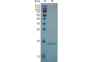 Human RN Protein, His Tag on SDS-PAGE under reducing condition.