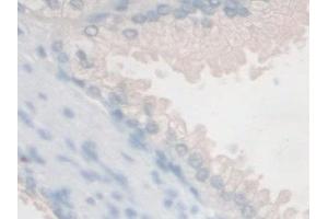 Detection of FSTL1 in Human Prostate Tissue using Polyclonal Antibody to Follistatin Like Protein 1 (FSTL1)