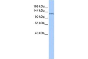 Western Blotting (WB) image for anti-Nucleoporin 155kDa (NUP155) antibody (ABIN2463616) (NUP155 anticorps)