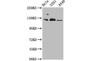 Western Blot Positive WB detected in: Hela whole cell lysate, U251 whole cell lysate, A549 whole cell lysate All lanes: FBLN2 antibody at 3. (FBLN2 anticorps  (AA 301-440))