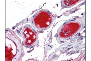 Small intestine, vessels: Formalin-Fixed, Paraffin-Embedded (FFPE)