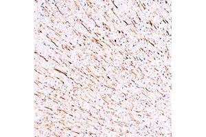 Immunohistochemistry (Formalin/PFA-fixed paraffin-embedded sections) staining of rat brain using Map1a monoclonal antibody, clone MP-1 . (MAP1A anticorps)