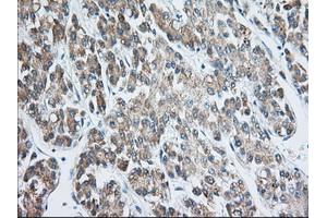 Image no. 4 for anti-Eukaryotic Translation Initiation Factor 2 Subunit 1 (EIF2S1) antibody (ABIN1497972)