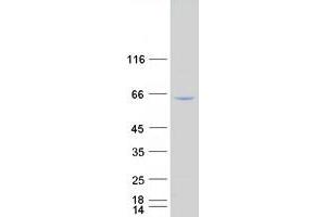 Validation with Western Blot