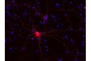 Indirect immunostaining of PFA fixed rat hippocampus neurons (dilution 1 : 500; red). (Calbindin D28k/D29k anticorps)