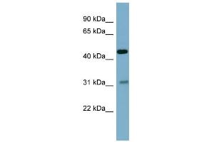 WB Suggested Anti-OMD Antibody Titration: 0. (Osteomodulin anticorps  (Middle Region))
