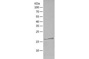 Western Blotting (WB) image for Retinoic Acid Early Transcript 1G (RAET1G) (AA 26-213) protein (His-IF2DI Tag) (ABIN7124844)