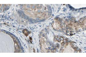 ABIN6275372 at 1/100 staining Human prostate tissue by IHC-P. (KCNK15 anticorps  (C-Term))