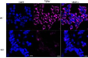 anti-Ts Translation Elongation Factor, Mitochondrial (TSFM) antibody
