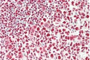 ABIN5539622 (5µg/ml) staining of paraffin embedded Human Tonsil. (c-FOS anticorps  (AA 283-295))