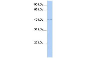 FAM50B antibody used at 1 ug/ml to detect target protein. (FAM50B anticorps  (N-Term))