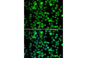Immunofluorescence analysis of A-549 cells using FKBP6 antibody. (FKBP6 anticorps  (AA 1-327))
