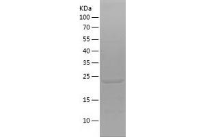 Western Blotting (WB) image for FYVE, RhoGEF and PH Domain Containing 5 (FGD5) (AA 435-639) protein (His tag) (ABIN7123024)