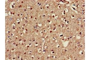 Immunohistochemistry of paraffin-embedded human brain tissue using ABIN7146747 at dilution of 1:100 (NOS1AP anticorps  (C-Term))