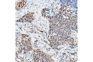 IHC analysis of SNRNP27 using anti-SNRNP27 antibody (ABIN7599614). (SNRNP27 anticorps  (AA 100-155))