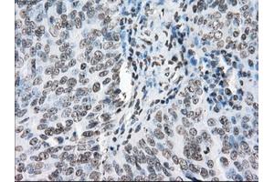 Immunohistochemical staining of paraffin-embedded endometrium tissue using anti-PORmouse monoclonal antibody. (POR anticorps)