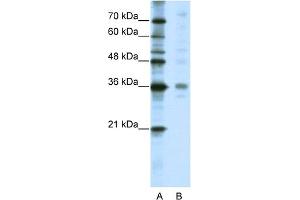 WB Suggested Anti-CRSP8 Antibody Titration:  5. (MED27 anticorps  (C-Term))