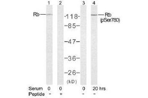 Image no. 2 for anti-Retinoblastoma 1 (RB1) (Ser780) antibody (ABIN197284) (Retinoblastoma 1 anticorps  (Ser780))